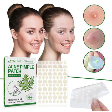 144 Patches Acne Pimple Patch Tea Tree Oil Serum Acne Treatment Pimple