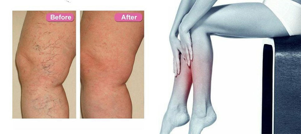 VeinEase Repair Lotion