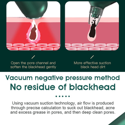 Hot Compress Blackhead Remover