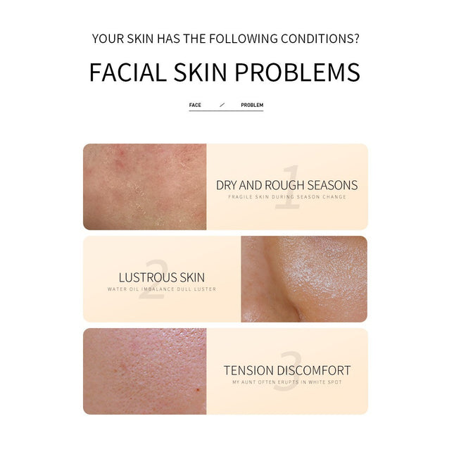 Puree Skin Rejuvenation Moisturizing Six-piece Set Hydrating Skin Care Products