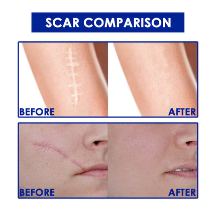 Skin Care Gel Skin Concave And Convex Wound