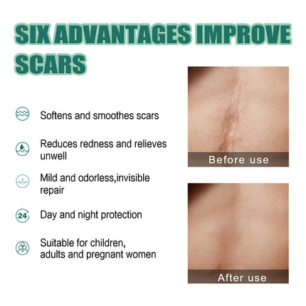 Fade Scar Smooth Skin Moisturizing Repair Skin Care Gel