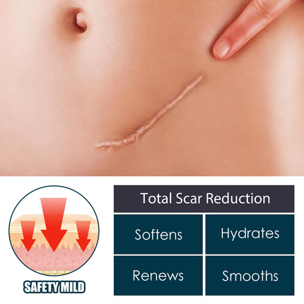 Skin Repair Gel Mild Care