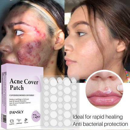 Smallpox Diluting Skin Care Patch