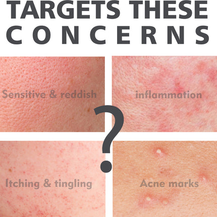 Salicylate Skin Repair Acne Skin Care Water