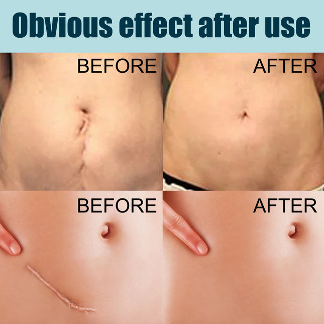 RevitaSkin Recovery Gel