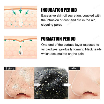 10 100pcs Nose Blackhead Remover Mask Deep Cleansing Skin Care Shrink