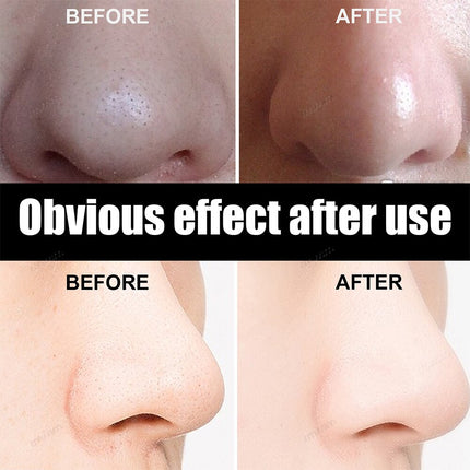 10 100pcs Nose Blackhead Remover Mask Deep Cleansing Skin Care Shrink