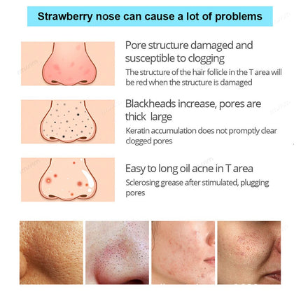 10 100pcs Nose Blackhead Remover Mask Deep Cleansing Skin Care Shrink