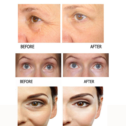 Eye Cream To Remove Eye Bags, Eye Cream Essence, Eye Bag Care, Eye Care