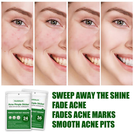 36pcs Acne Pimple Patch Invisible Waterproof Absorb Pus Acne Treatment