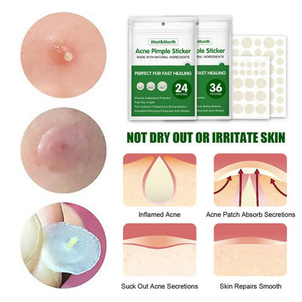 36pcs Acne Pimple Patch Invisible Waterproof Absorb Pus Acne Treatment