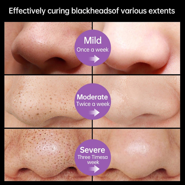 Auquest Blackhead Remover Nose Face Mask Pore Deep Cleansing Shrink