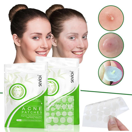 Acne Patch Pus absorbing Invisible Acne Pimple Patch Skin Care