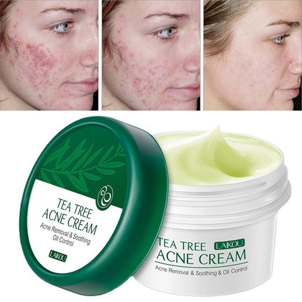 Acne Removal Cream Treatment Pimples Acne Scar Shrink Pores Oil