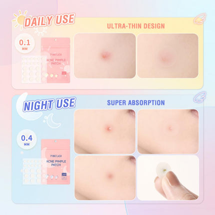 Daily/Night Skin Care Acne Patch Tea Tree Oil Acne Remover Acne Pimple