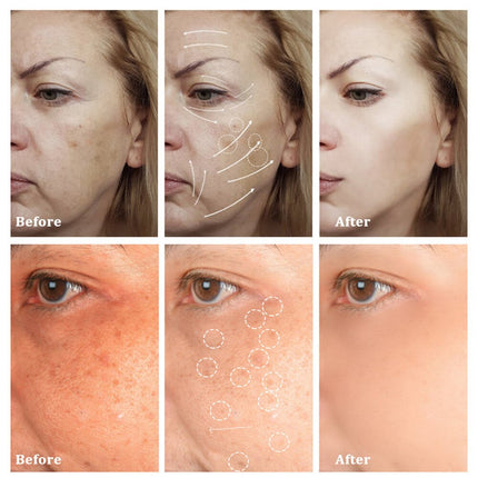 Freckle Removal Cream Whitening Cream Remove Dark Spots Melanin