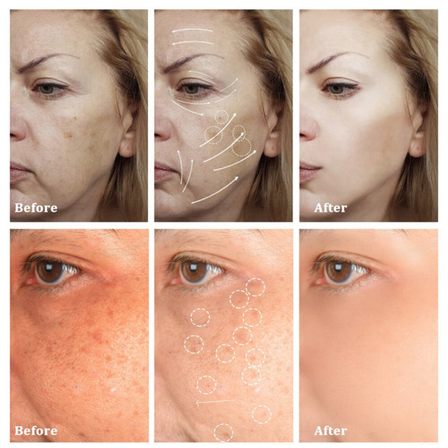 Freckle Removal Cream Whitening Cream Remove Dark Spots Melanin
