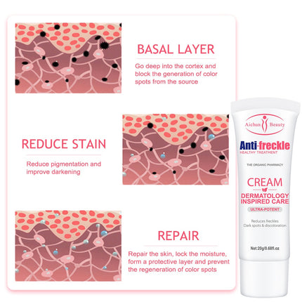 Freckle Removal Cream Whitening Cream Remove Dark Spots Melanin