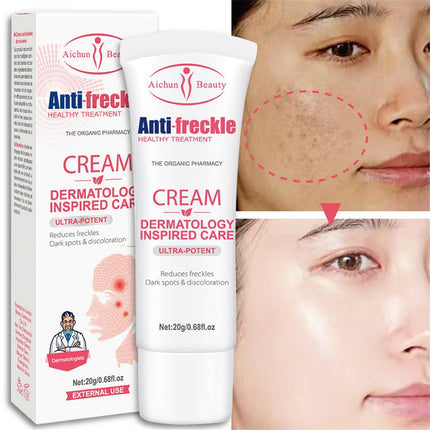 Freckle Removal Cream Whitening Cream Remove Dark Spots Melanin