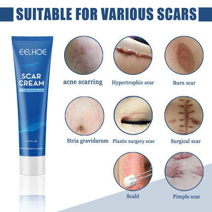 Herbal Scar Removal Face Cream Treatment Stretch Marks Burns Surgery