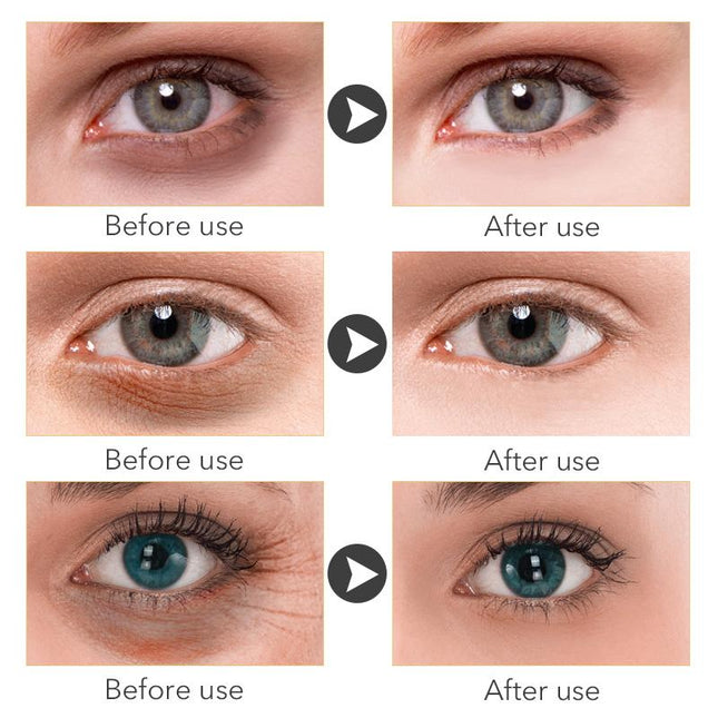 Instant Remove Wrinkles Retinol Face Cream Lifting Anti Aging Anti Eye