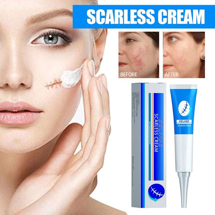 Natural Scar Removal Cream Gel Whiten Pock Mark Burn Surgical Scar