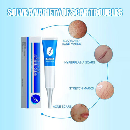 Natural Scar Removal Cream Gel Whiten Pock Mark Burn Surgical Scar