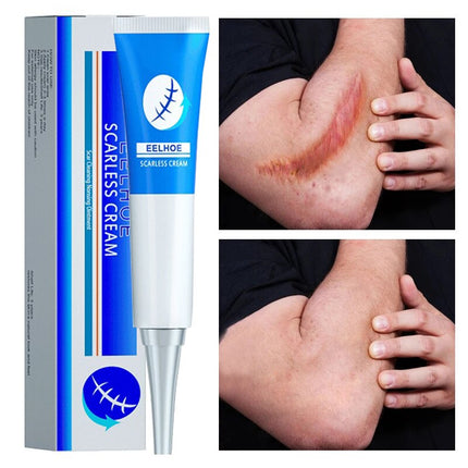 Natural Scar Removal Cream Gel Whiten Pock Mark Burn Surgical Scar