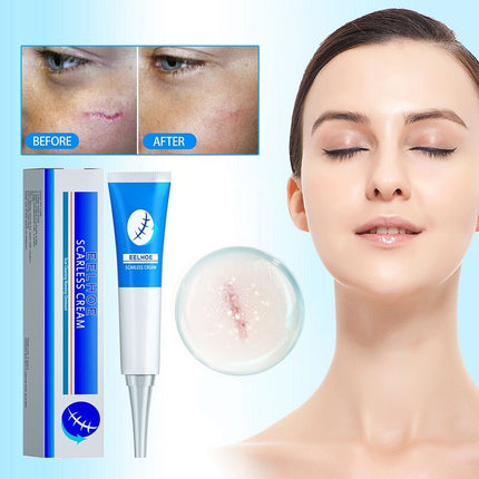 Natural Scar Removal Cream Gel Whiten Pock Mark Burn Surgical Scar