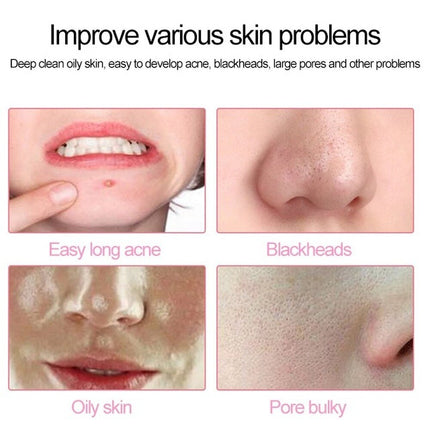 Waterproof Silicone Facial Cleansing Brush Face Brush   Massage Skin