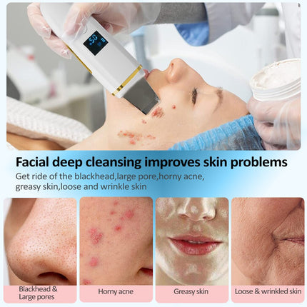 Z9 Facial Skin Scrubber Ultrasonic Shovel Cleaner Dead Skin Peeling