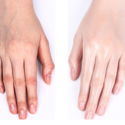 Moisturizing And Hydrating Hand Care Skin Care