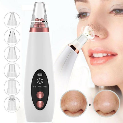 USB Blackhead & Black Dot Remover